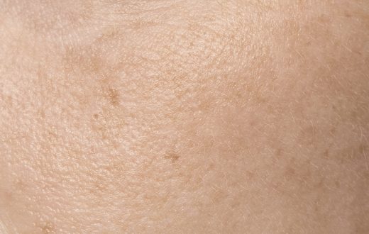 Natural Anti-Aging