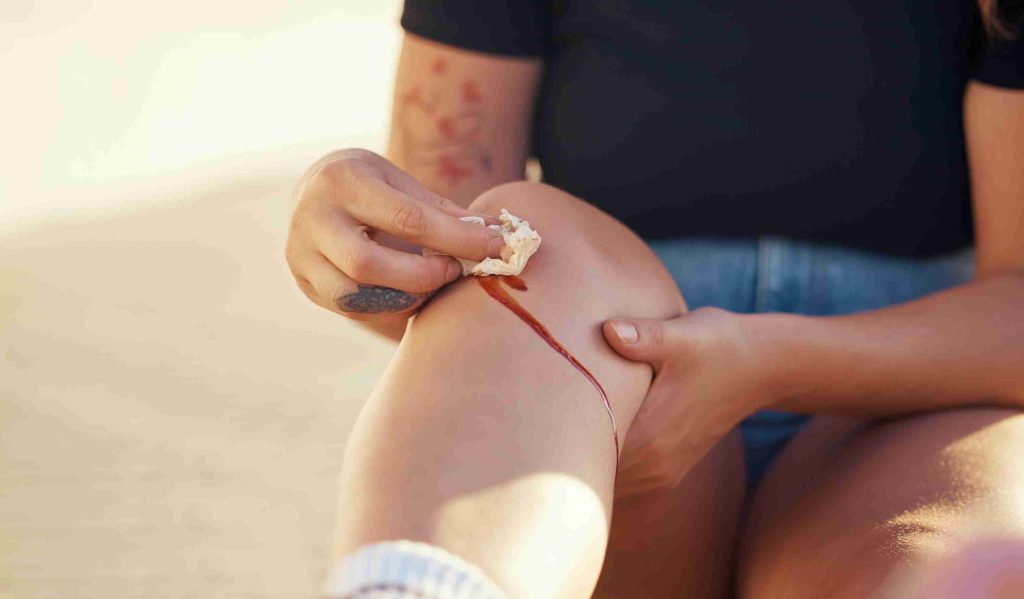 knee injury person cleaning blood wound with tissue stop bleeding healing recovery self care hygiene after accident with torn sore skin leg infection prevention (1)
