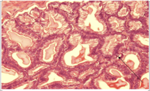 microso